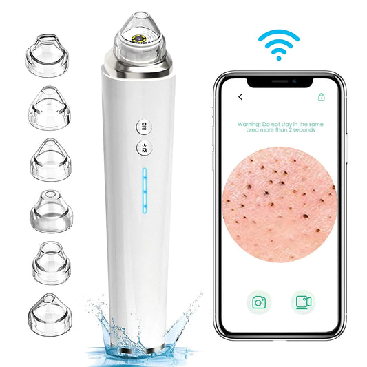 Blackhead Remover Pore Vacuum with HD Camera, Black Head Remover Suctioner 3 Suction Power & 6 Probes, Wifi Real-Time Skin Screen,Pimple Vacuum Acne Comedone Extractor